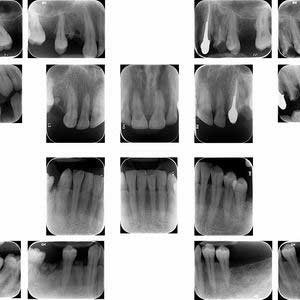 צילום שיניים דיגיטלי