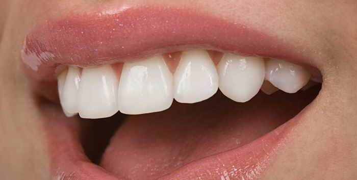 הלבנת שיניים ואסתטיקה